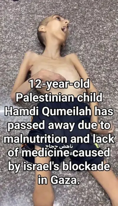 Children shot Gaza. Palestinian boy who died of starvation.