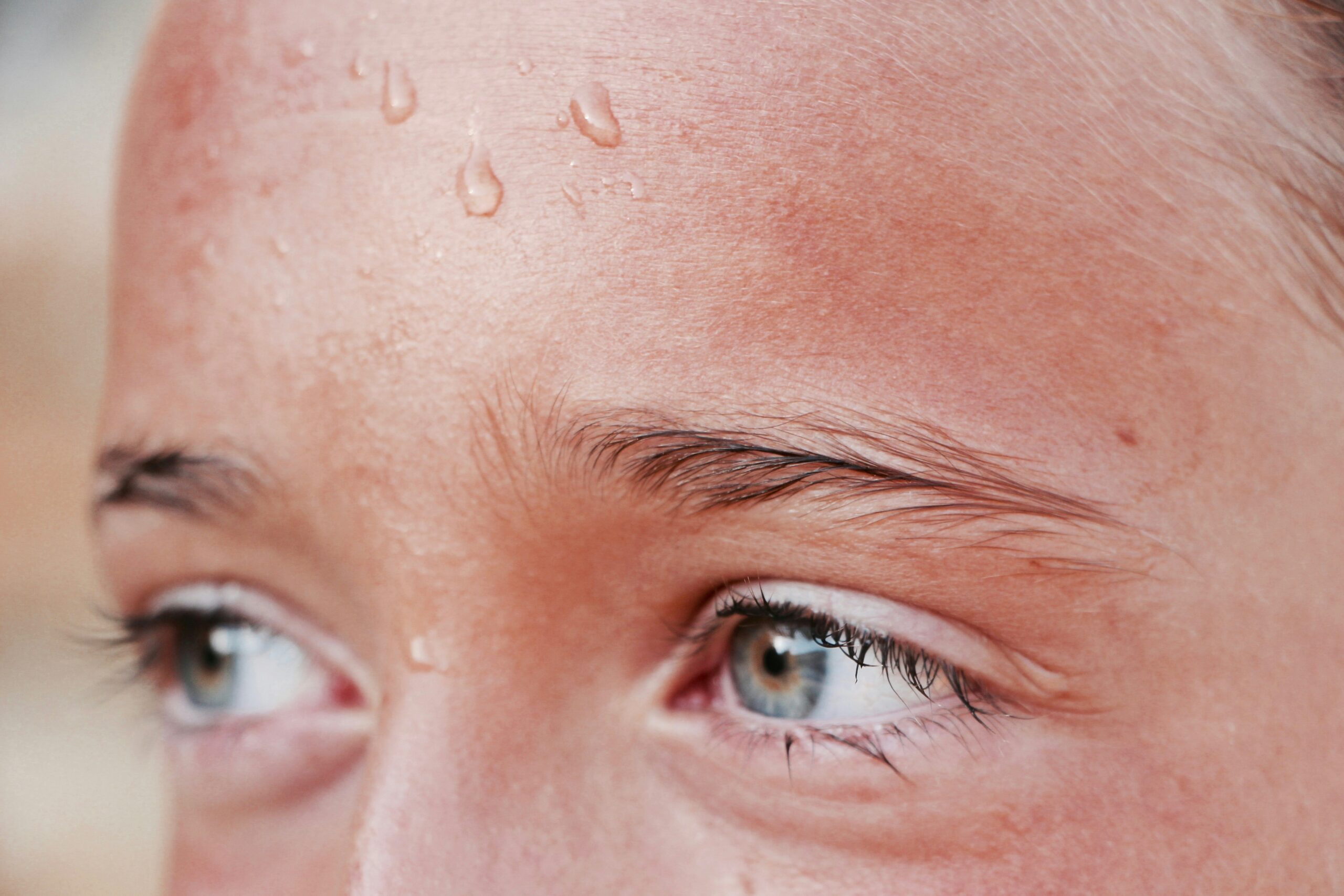 Rising temperatures the sweaty forehead of a woman