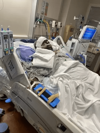 A man in a hospital bed in ICU