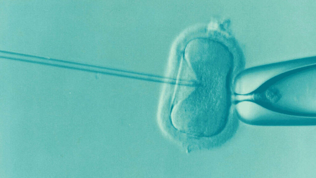 Microscopic image of uvf