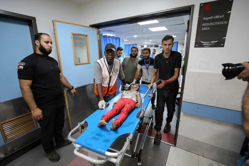 Wounded girl at al-shifa hospital in gaza