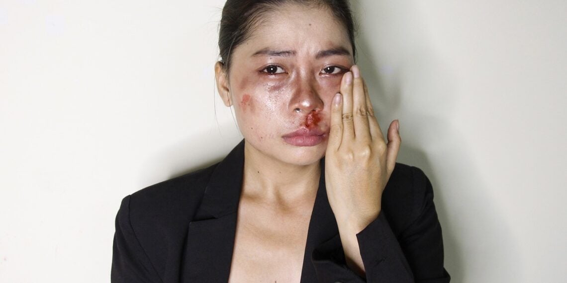 Victim of domestic violence, asian woman with bruises and blood on her face